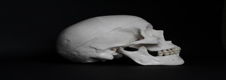 Skull Could Be an Unexpected Source of Immunity of the Brain